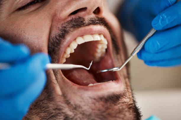 Best Orthodontic Emergency Dentist in Van, TX