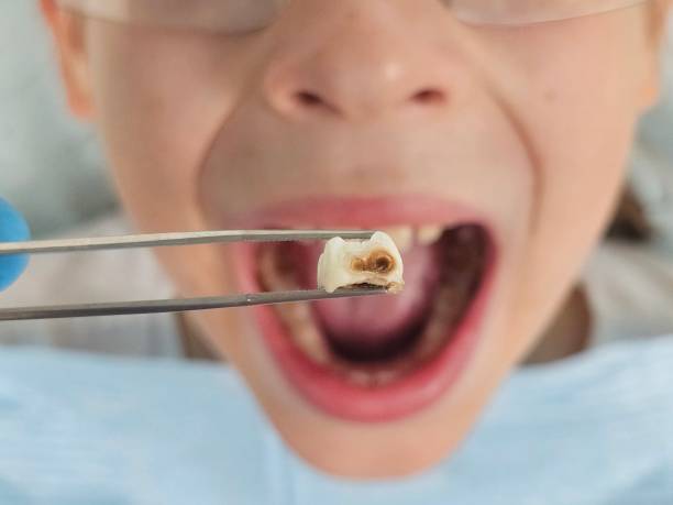 Best Holiday Emergency Dentist in Van, TX